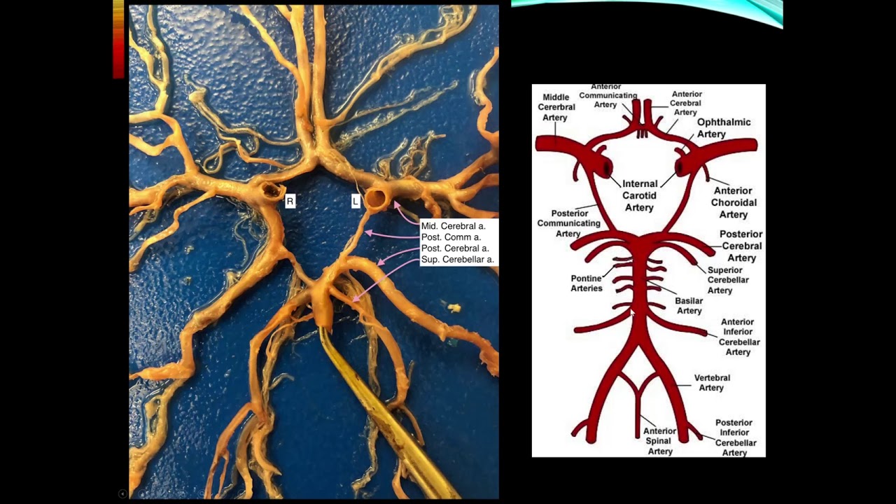 Cerebrovascular Disease,  Part 1