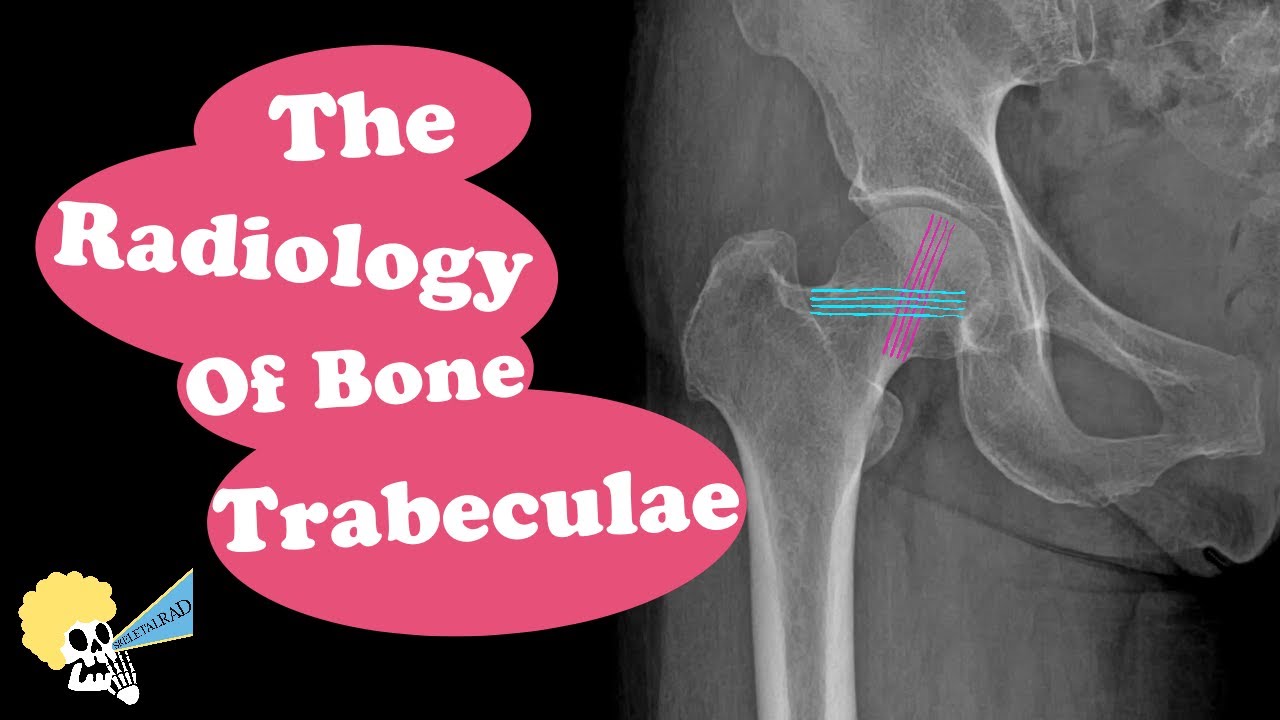 The Radiology of Bone Trabeculae