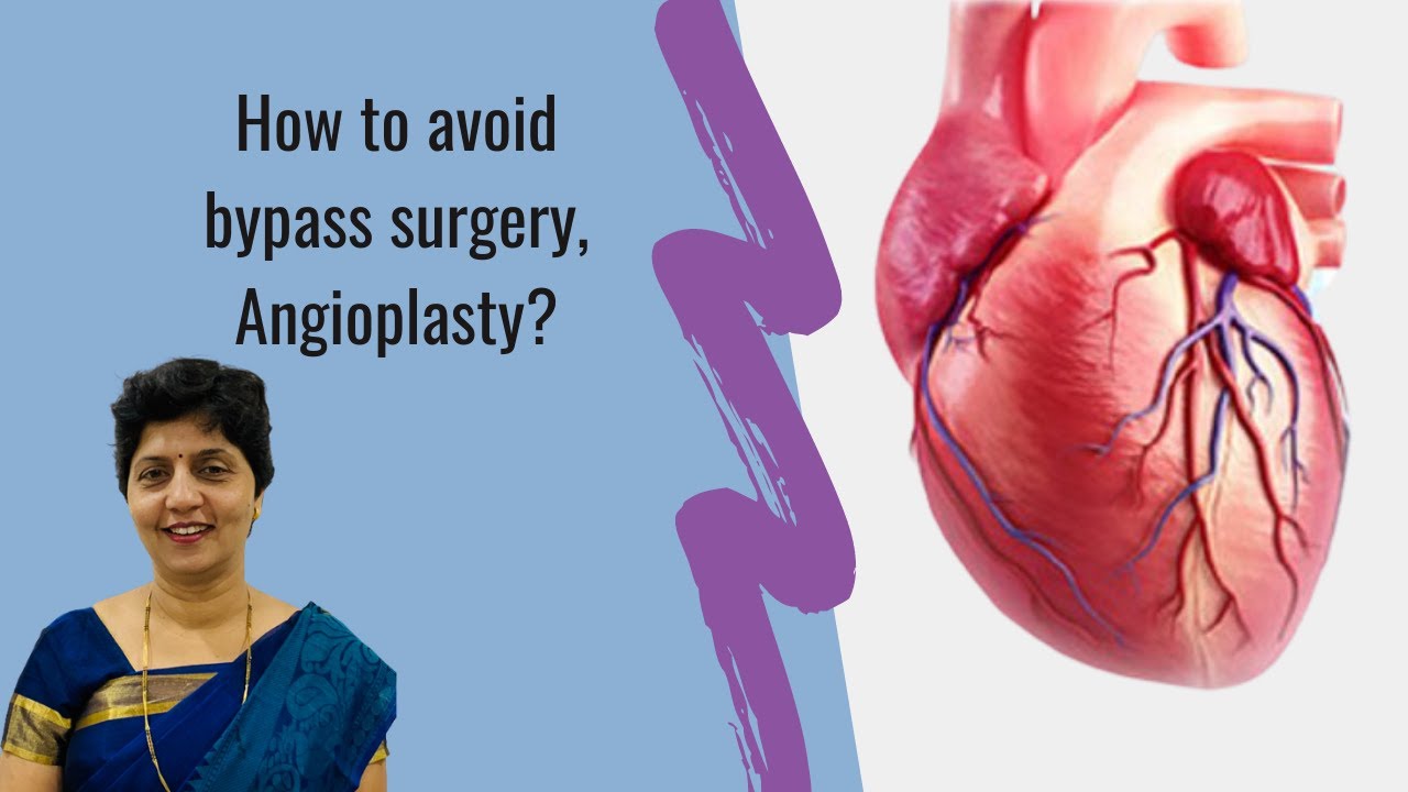 विना शस्त्रक्रिया हृदय उपचार | How to avoid bypass surgery, Angioplasty? | ज्योत्स्ना पाटील