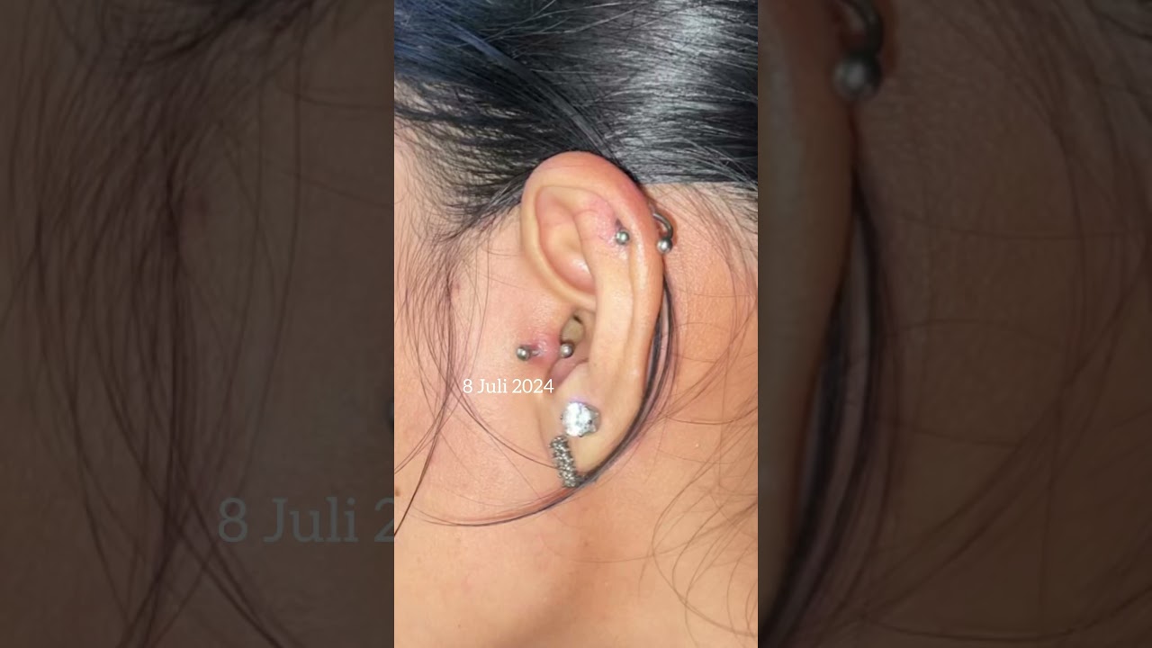 Mengatasi infeksi bekas tindik / piercing dengan cepat 😉