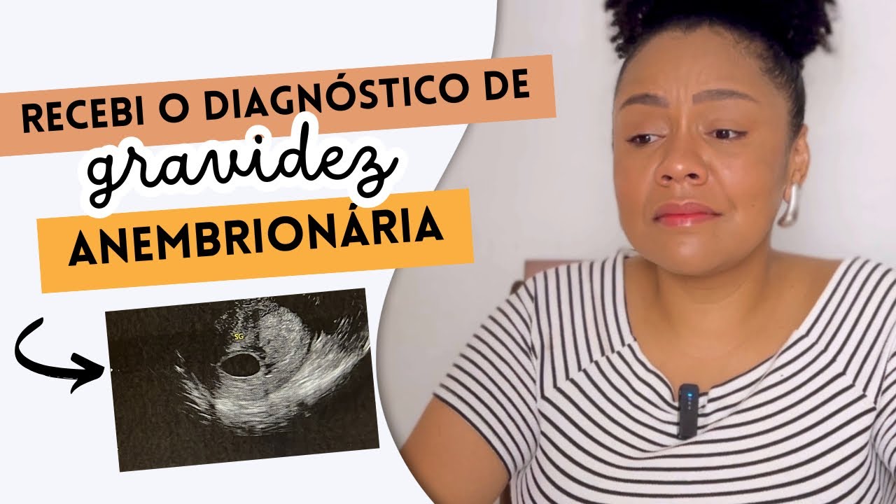 GRAVIDEZ ANEMBRIONÁRIA | Parte 1