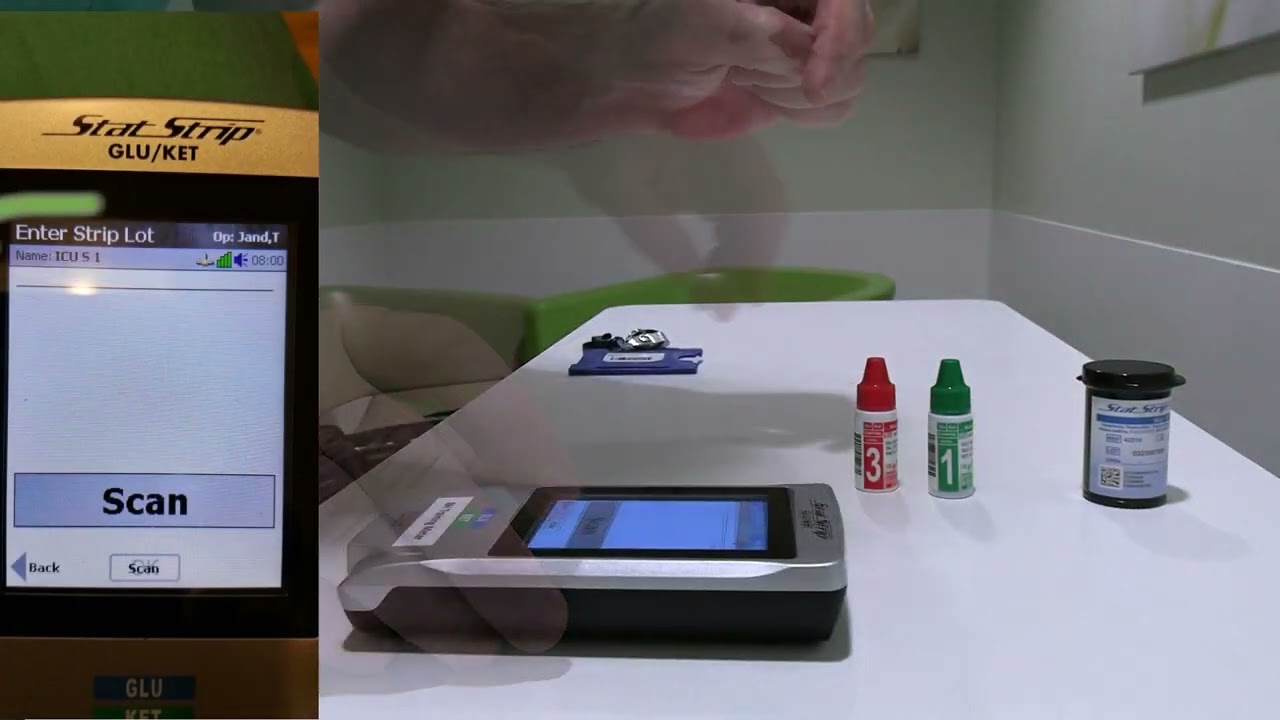 Nova glucometer