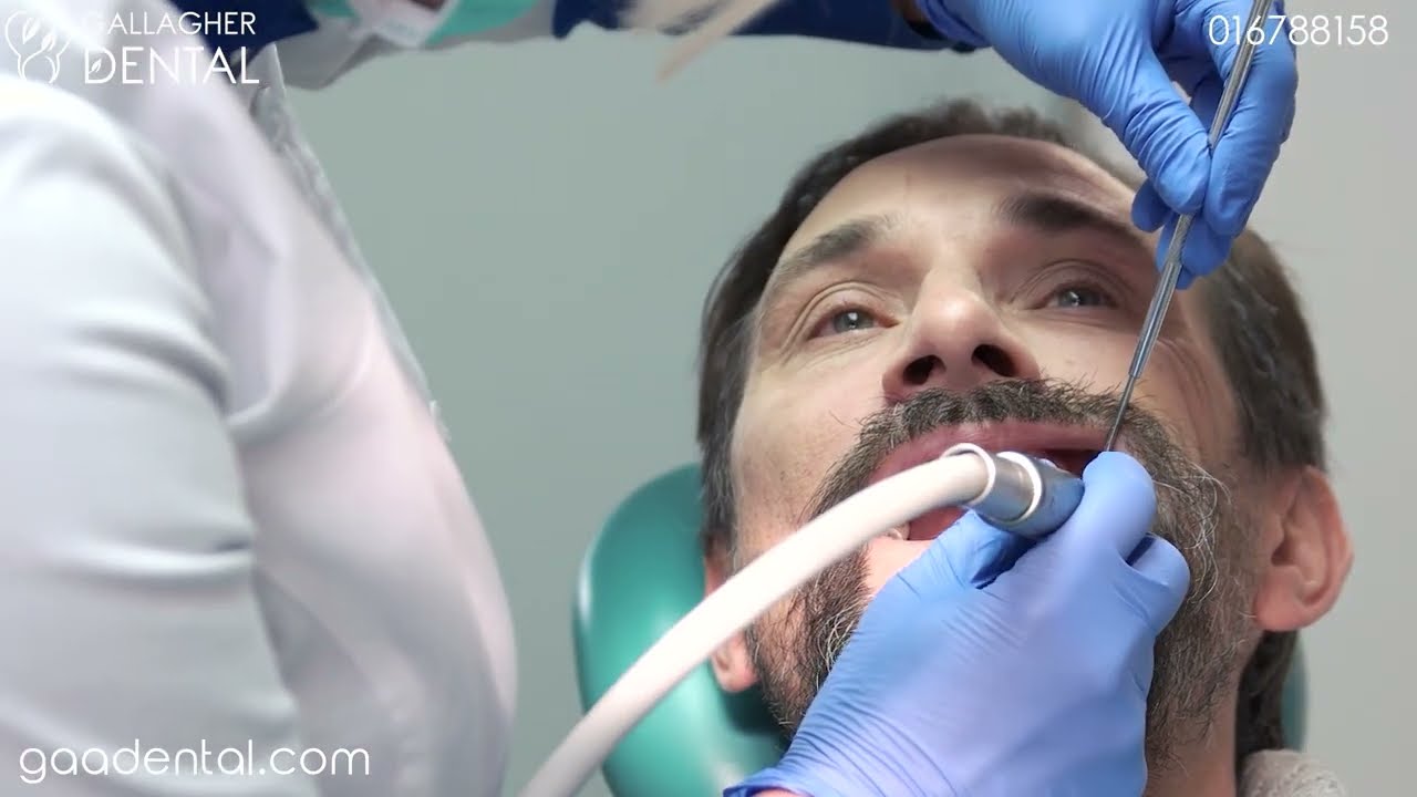 Tooth Fillings Dublin 2 - Gallagher Dental