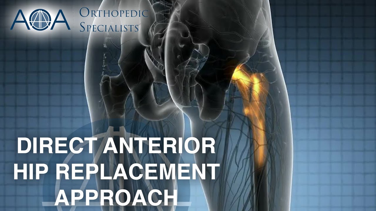 AOA Orthopedic Specialists - Direct Anterior Hip Replacement Approach