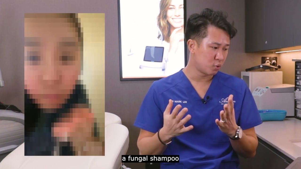 The Ultimate Guide to Treating Adult Acne in Singapore | Dr Mark Lim