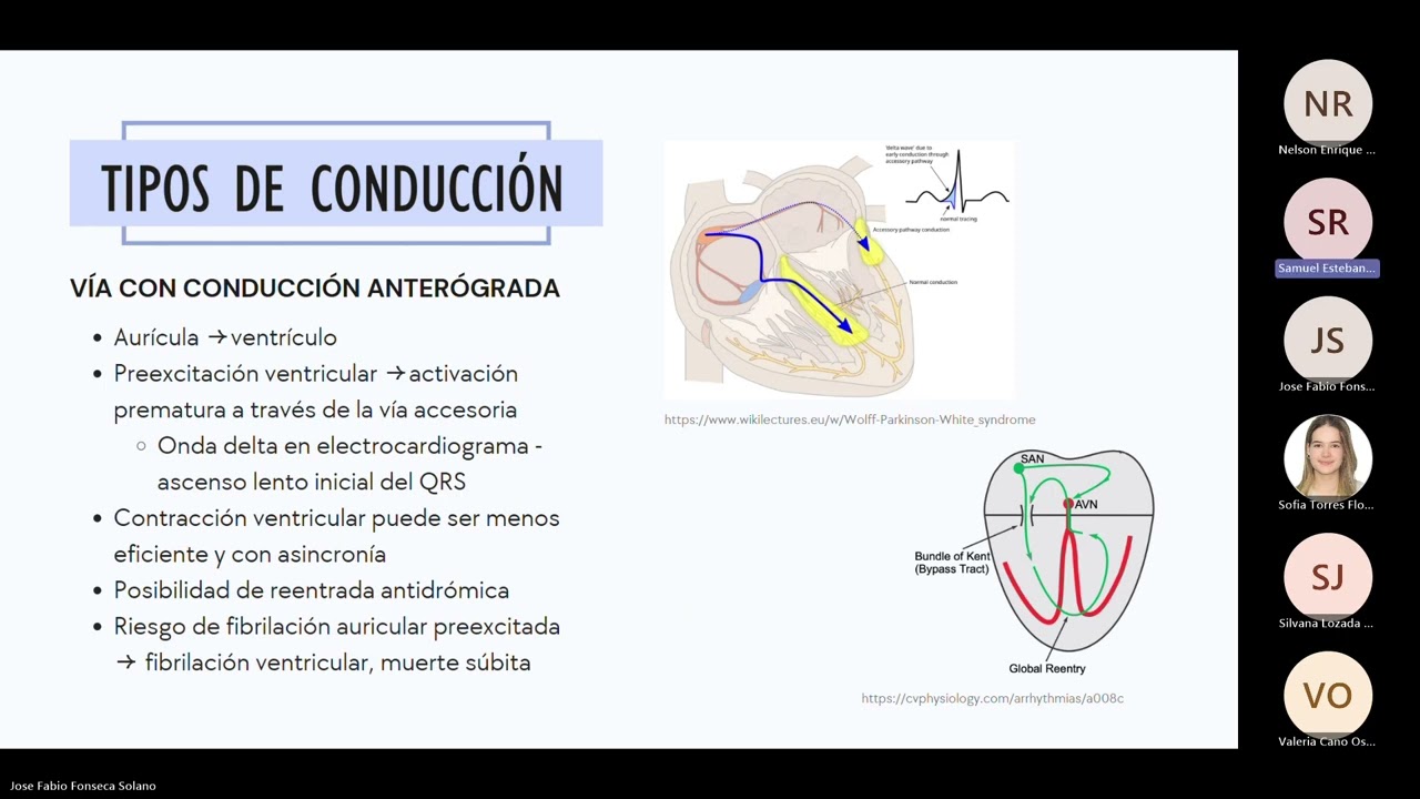 IMIG: Síndrome de Preexcitación