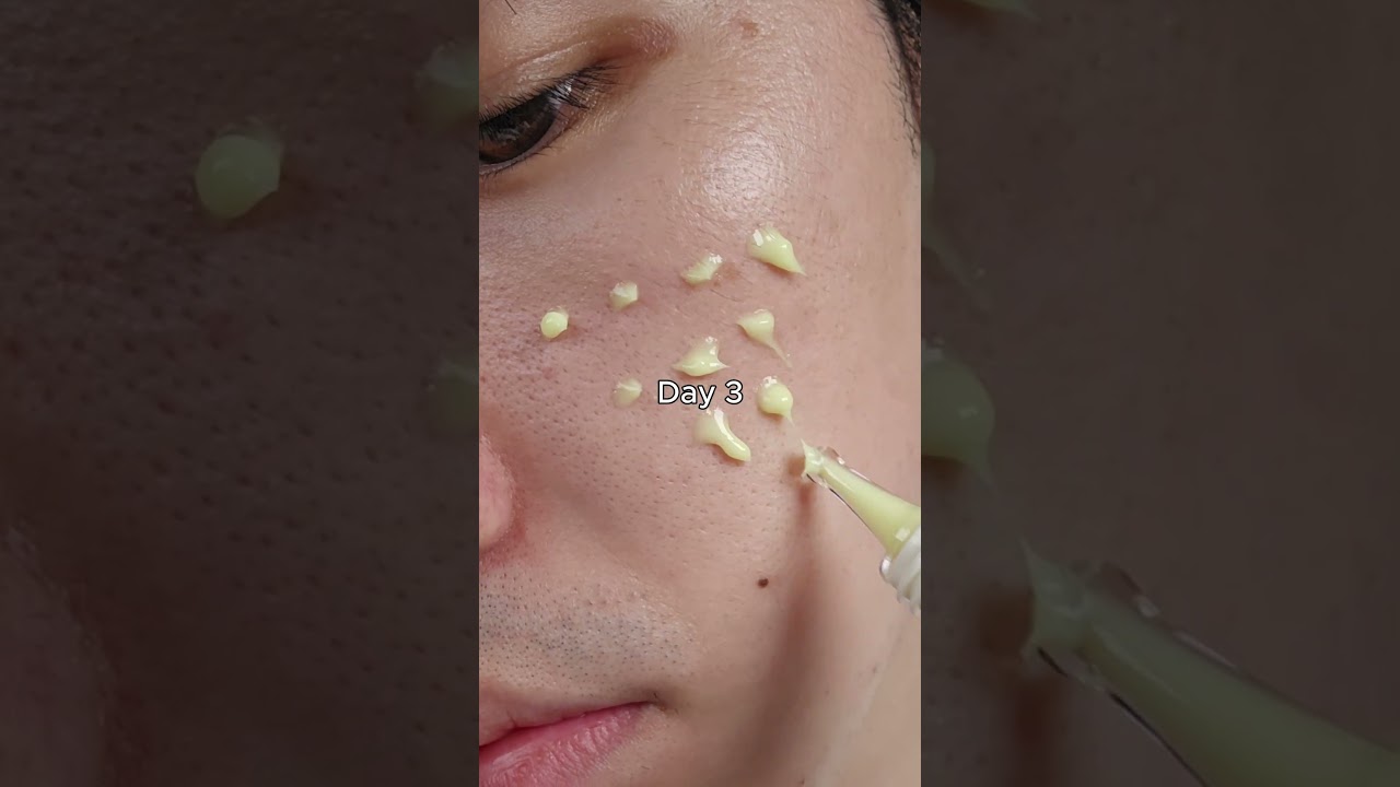 retinal with 7days#kskincare #skincare #skincareroutine #retinal #serum #pores #darkspots #kbeauty