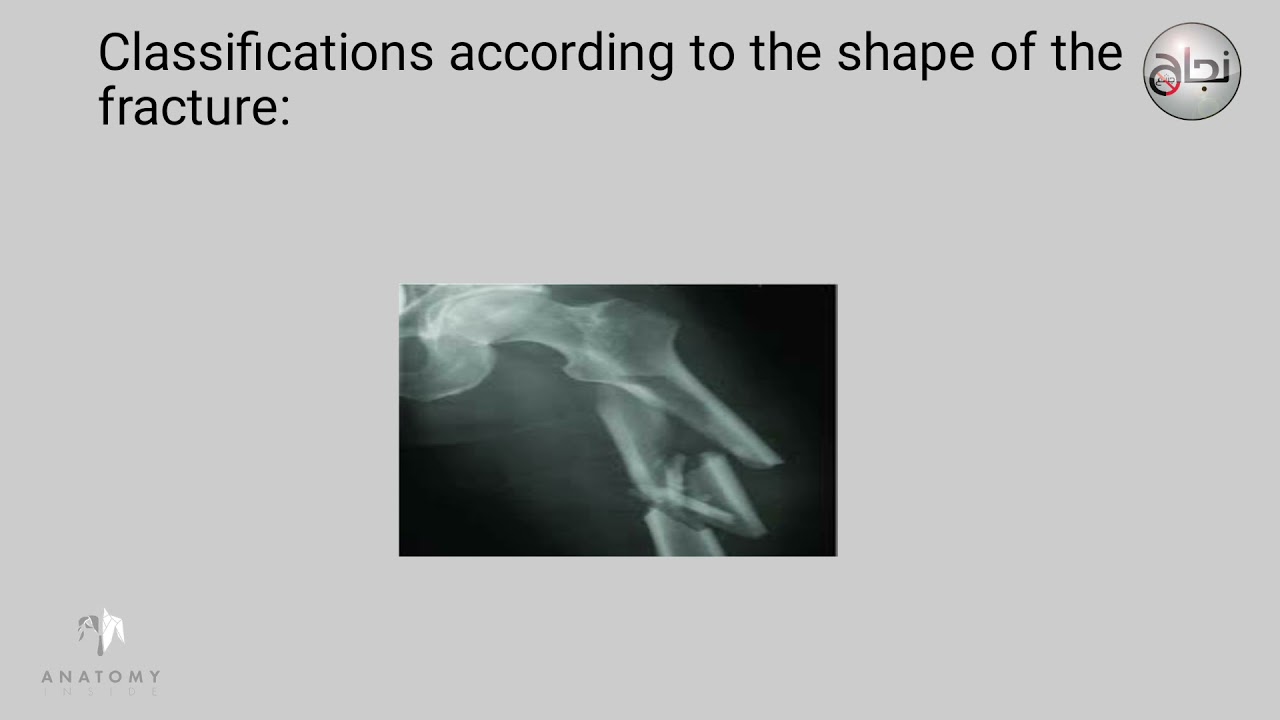 Introduction to Orthopedics, L1