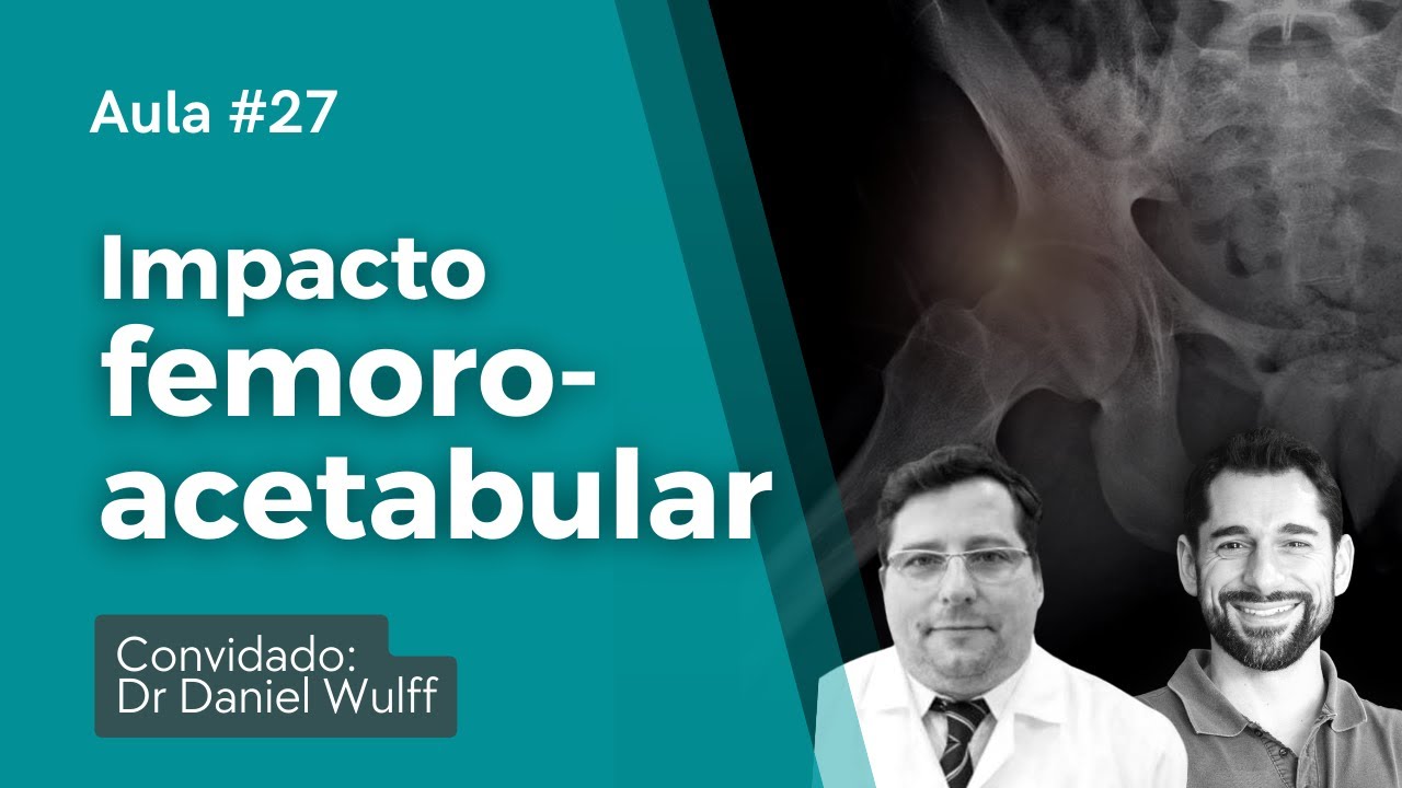 Aula #27 Impacto femuroacetabular - Convidado: Dr Daniel Wulff