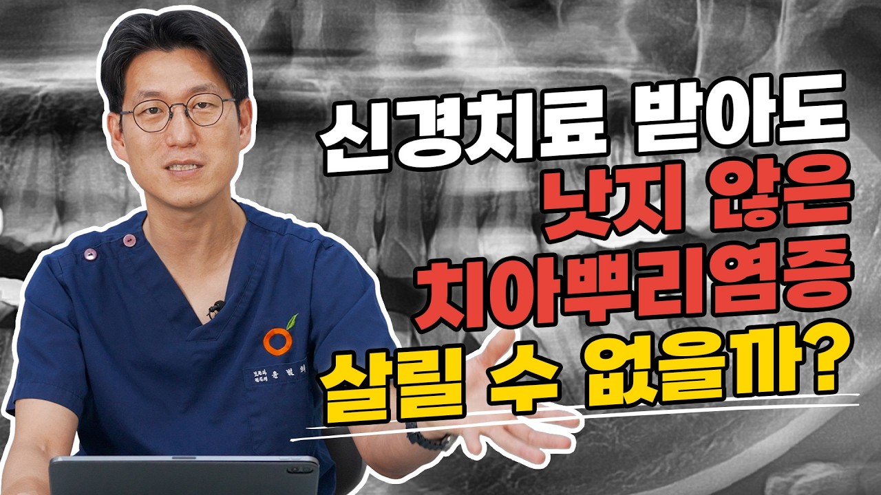 치아뿌리염증 재발, 대학병원에서도 발치? 치근단절제술 & 치아재식술로 어금니 살린 비결