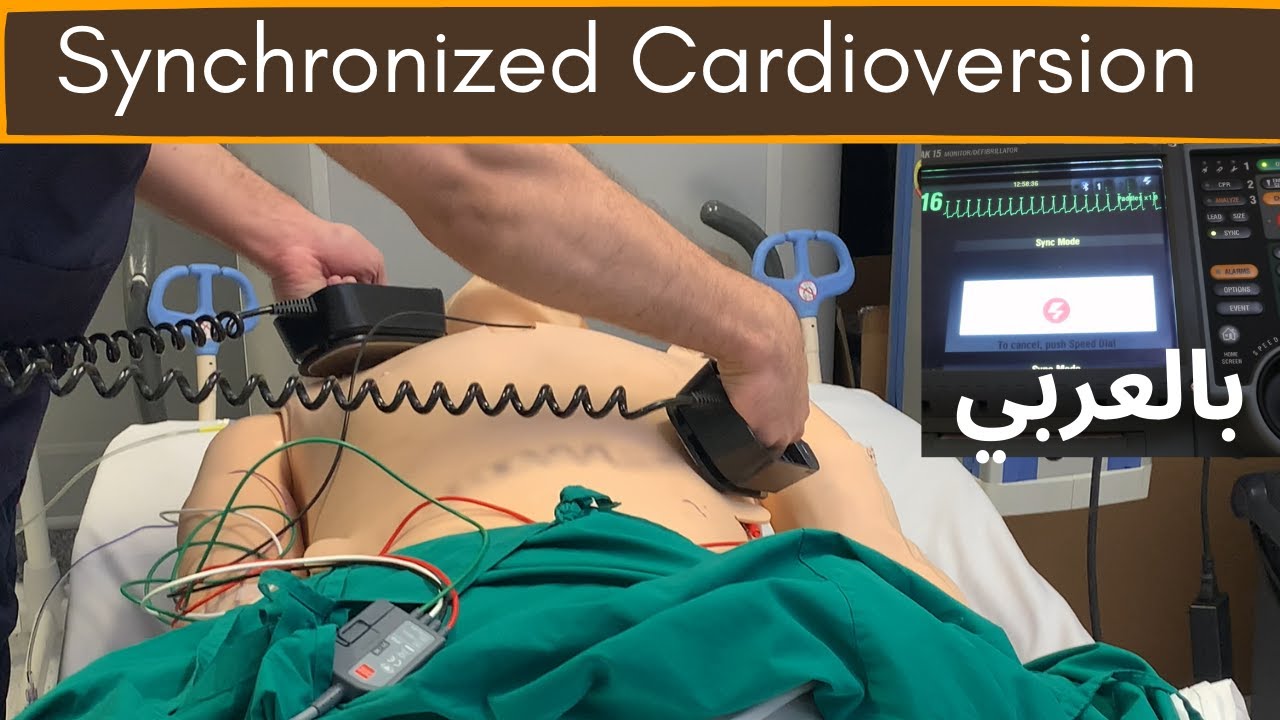 مزيل رجفان  القلب المتزامن [Synchronized Cardioversion]