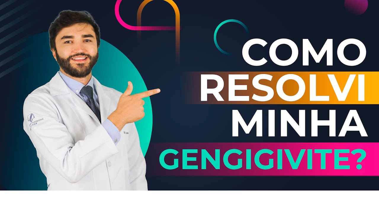 Como resolvi minha GENGIVITE | Dr Lucas Fustinoni