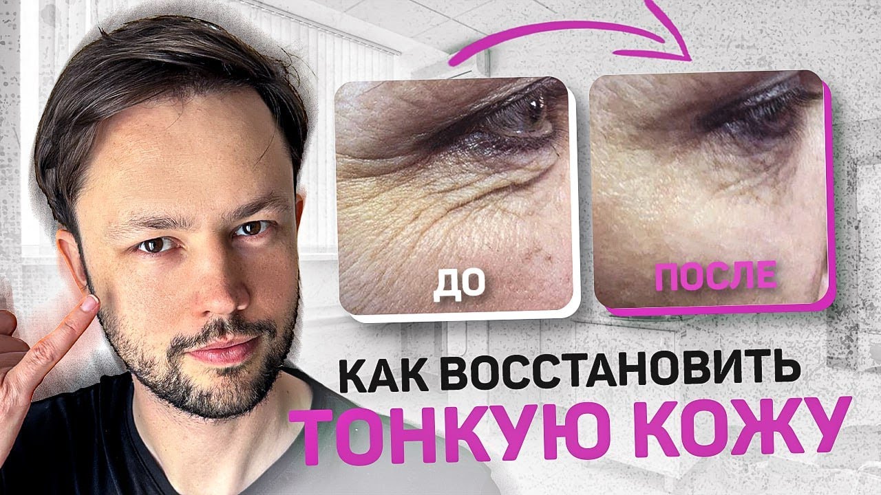 Как восстановить тонкую кожу?