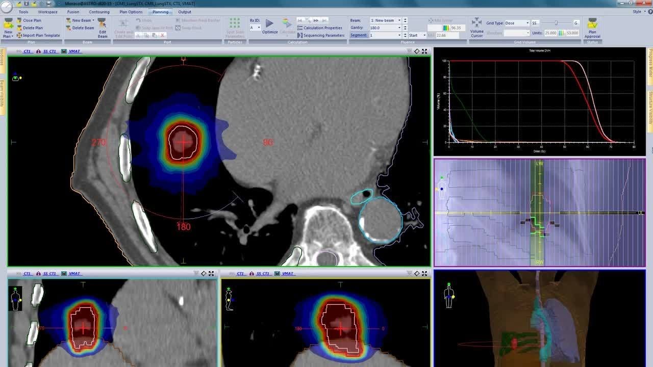 Advanced 4D image guidance for lung SBRT with Symmetry