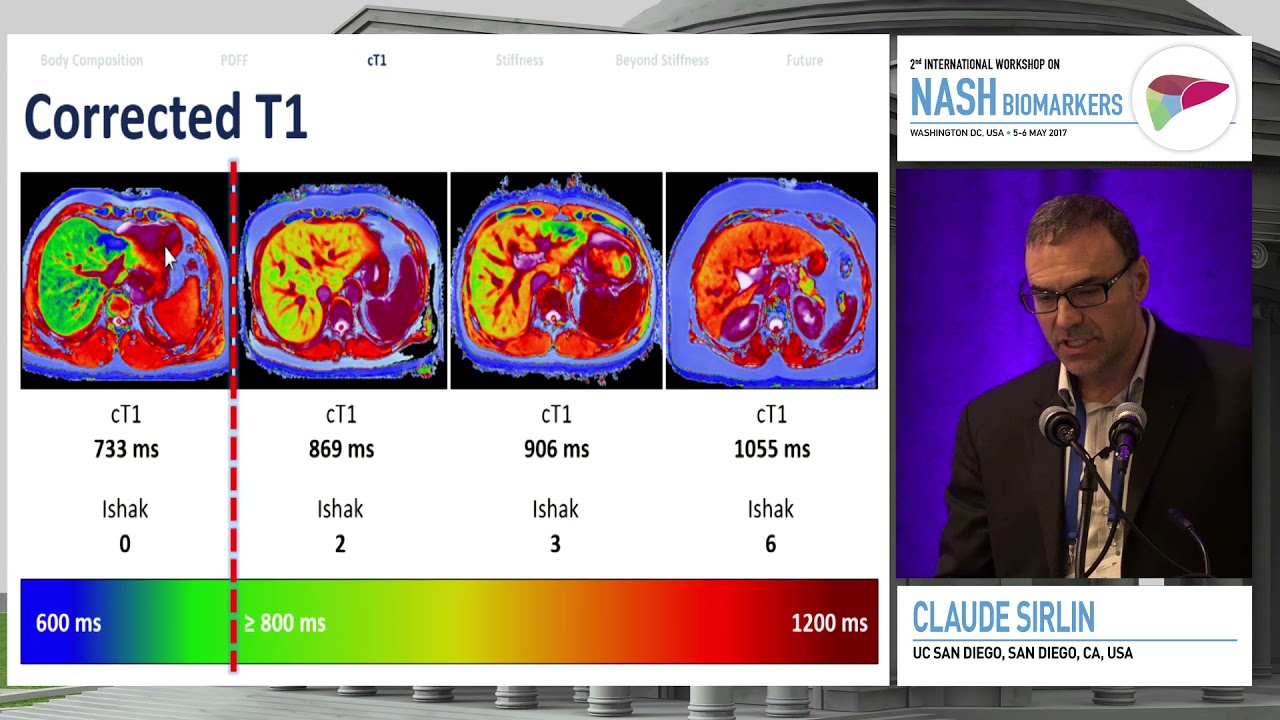 MRI; what can it deliver | Claude Sirlin, MD