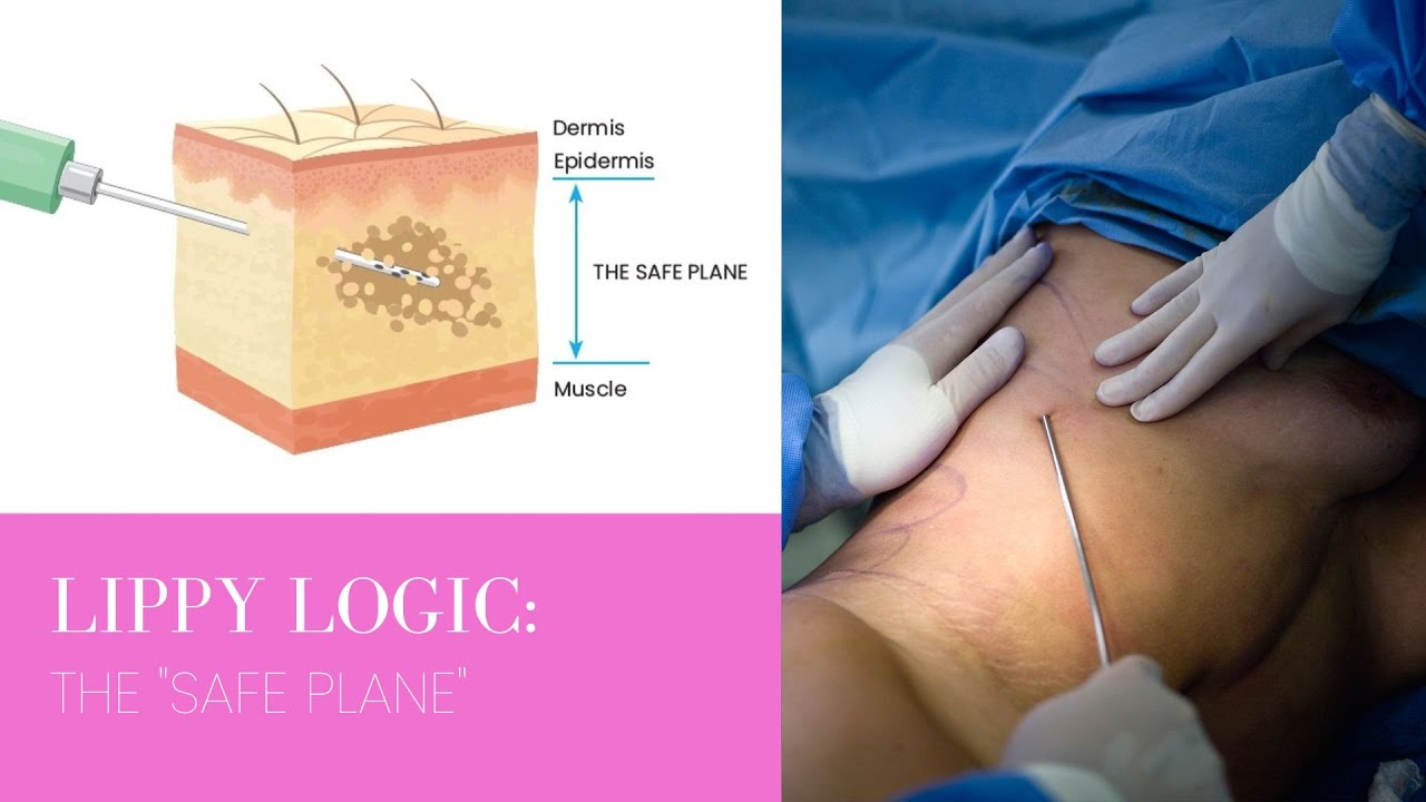 Lippy Logic™ | Episode 16: Safe Plane | With Dr. David Amron