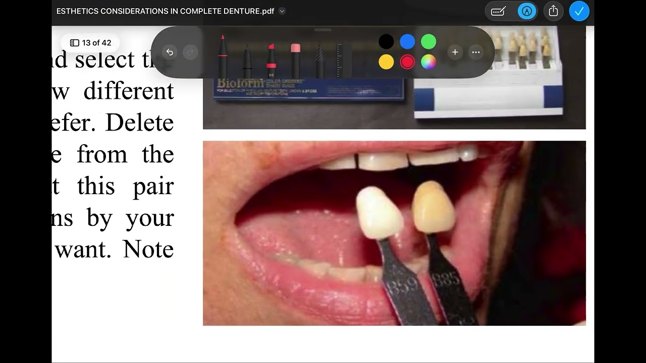 Esthetics considerations in complete denture