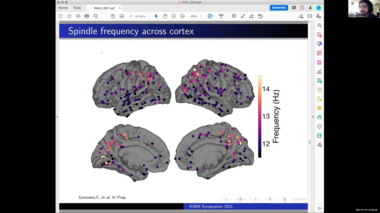 Christopher Gonzalez: Sleep spindle variability across the human cortex