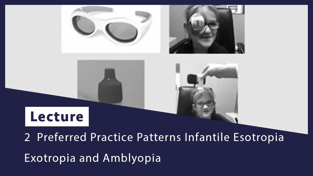 2  Preferred Practice Patterns Infantile Esotropia Exotropia and Amblyopia