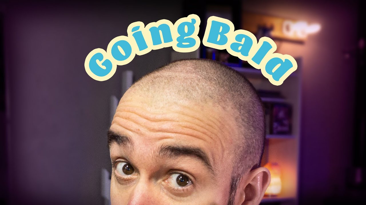 Embracing going Bald