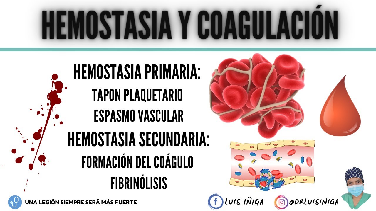 Hemostasia y Coagulación (Tapón plaquetario, Mecanismo general, Vía intrínseca y extrínseca)