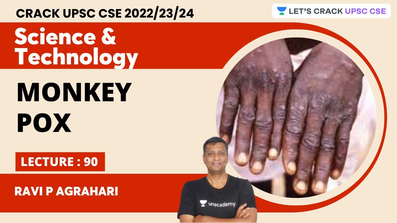 Science & Technology | L 90 | Monkey Pox | UPSC CSE | Ravi P Agrahari | Let's Crack UPSC CSE