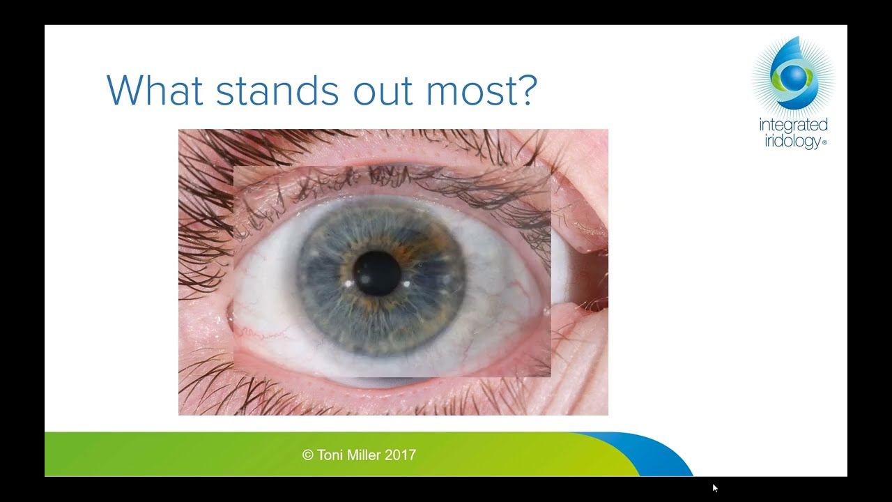 How to do an Iridology Assessment