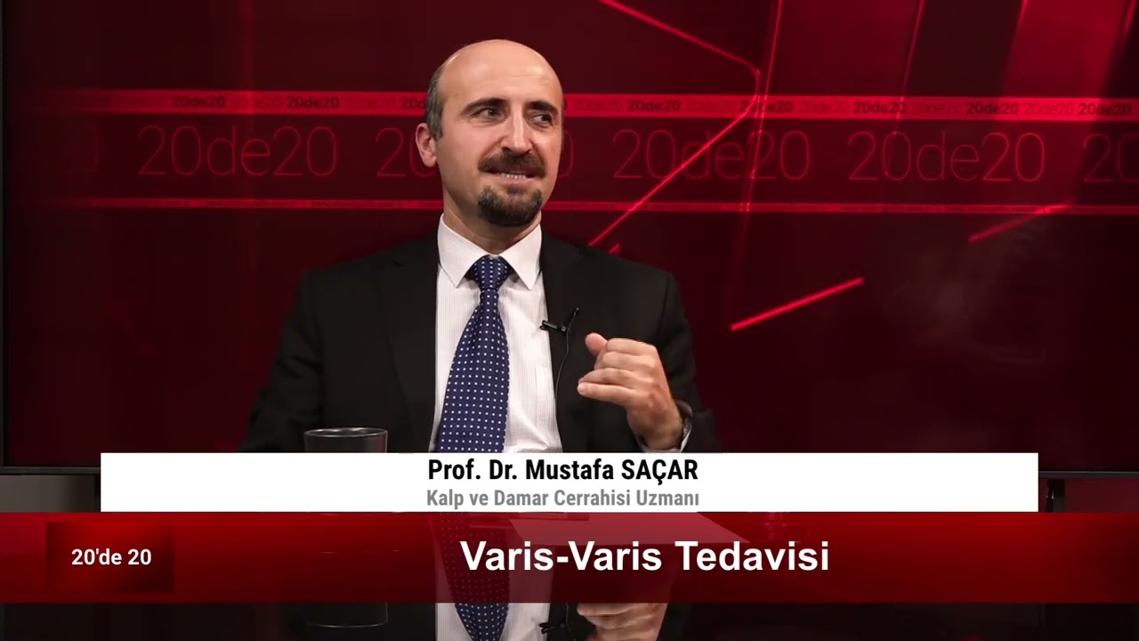 Varis Tedavisi - Prof. Dr. Mustafa Saçar