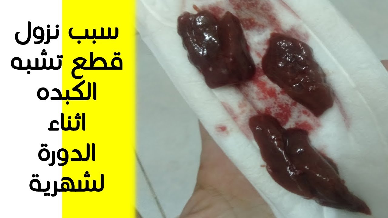 هذا هو سبب نزول قطع لحمية أو دم متجلط في وقت نزول الدورة الشهرية !! كتل دم متجلطة شبه الكبده