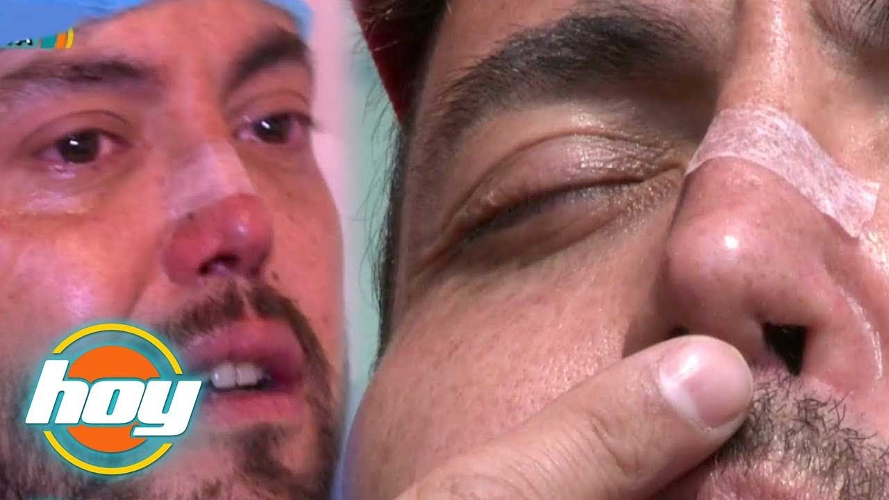 HOY | Mauricio Clark recuperó la nariz que le destruyó el consumo de drogas