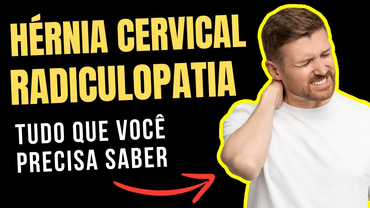 Radiculopatia Cervical Explicada De Forma Simples - Para Você Entender!