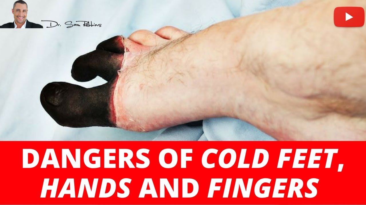 🚑 The Shocking Dangers of Poor Flow To Your Hands & Feet - Part 1 - by Dr Sam Robbins