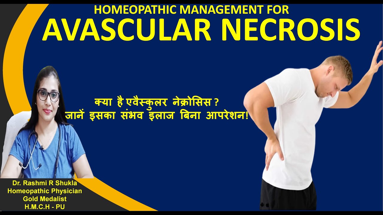 Avascular Necrosis|खून की कमी से हड्डियों(कूल्हे )के खोखला कर देने वाली बीमारी का होम्योपैथिक ईलाज