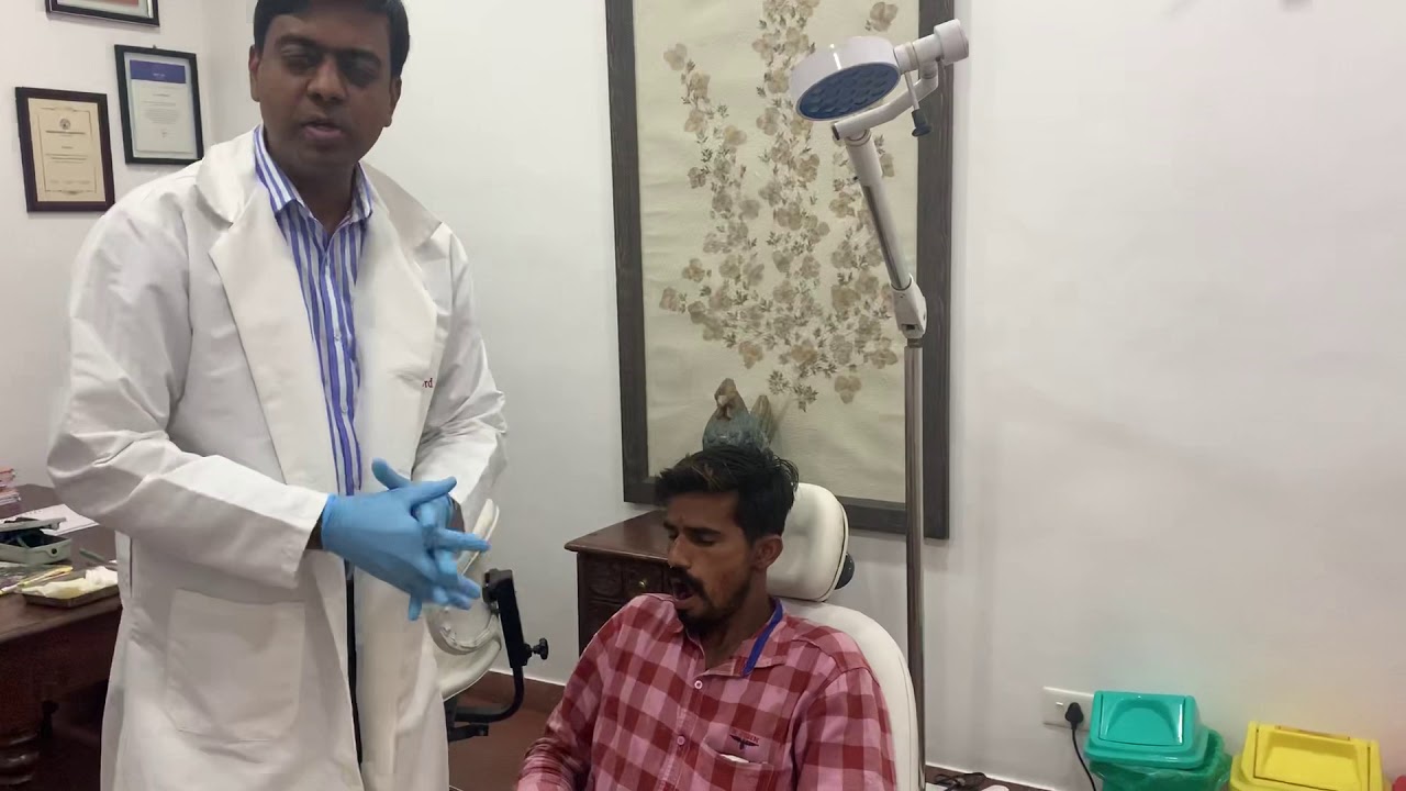 TMJ or lower jaw joint dislocation - Presenting findings and treatment - Hippocrates method