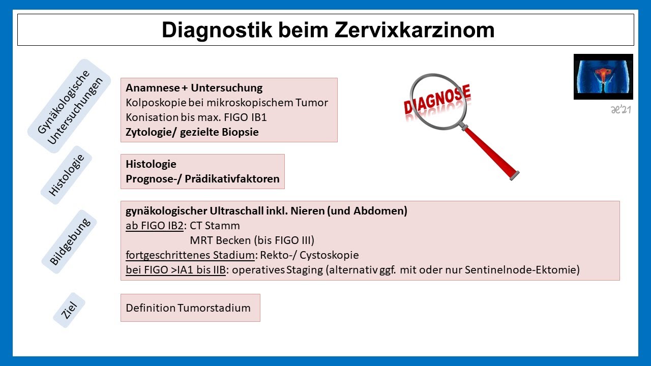 Diagnostik beim Zervixkarzinom | Strahlentherapie Prof. Hilke Vorwerk