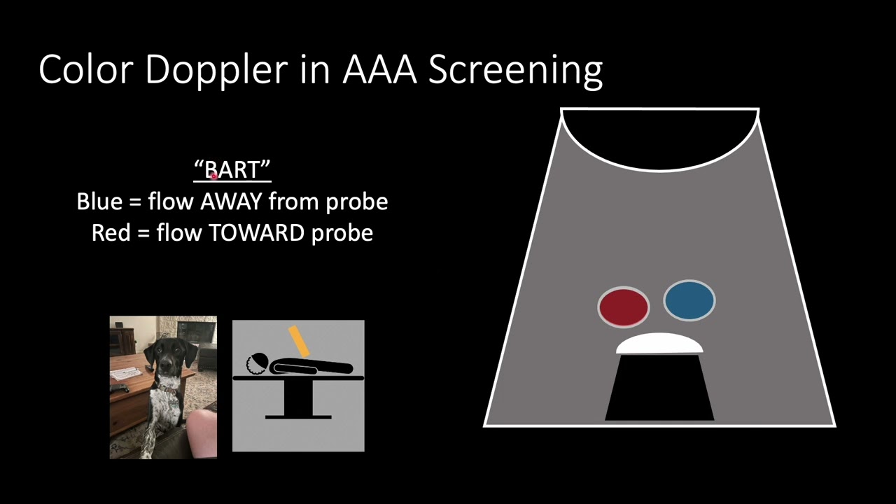 AAA & Aortic Dissection on POCUS | Screening, Scanning & Life-Saving Clues