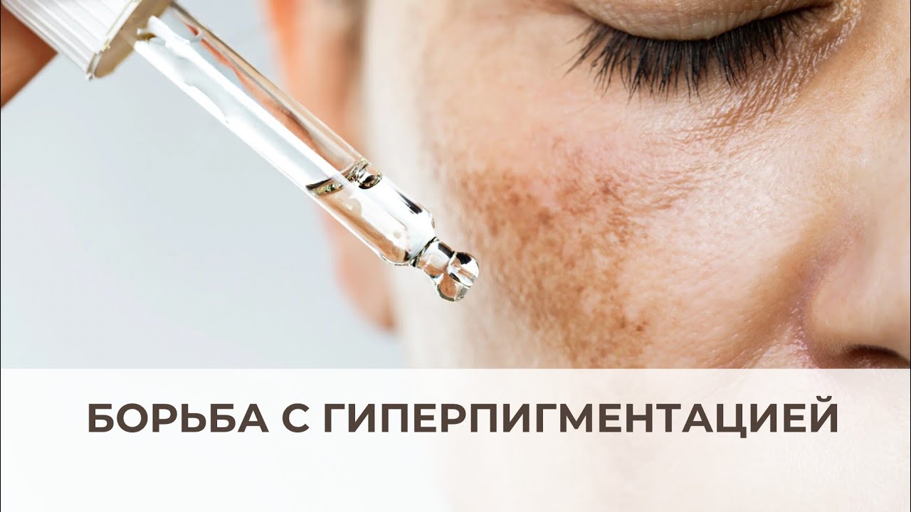 Борьба с гиперпигментацией Kosmoteros и Biotime