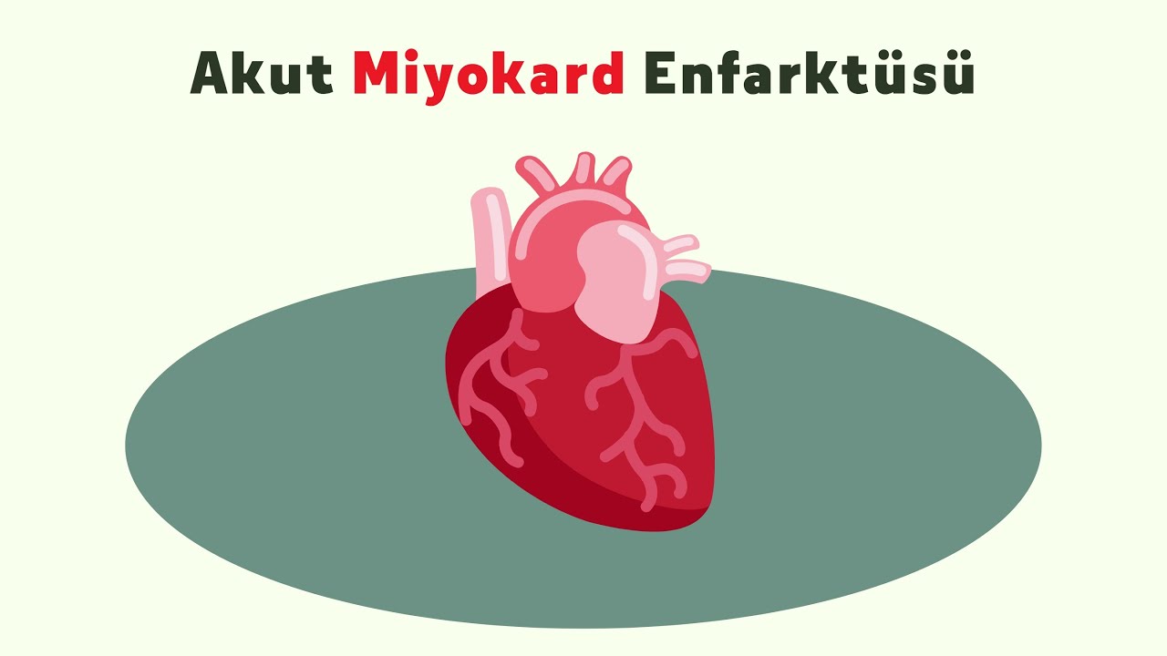 Myokard Enfarktüsü (Örnek Video 3)