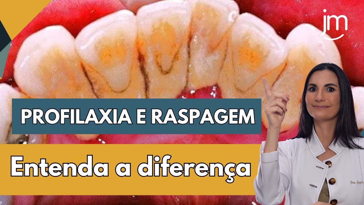 Raspagens ou só polimento! Qual a diferença. 