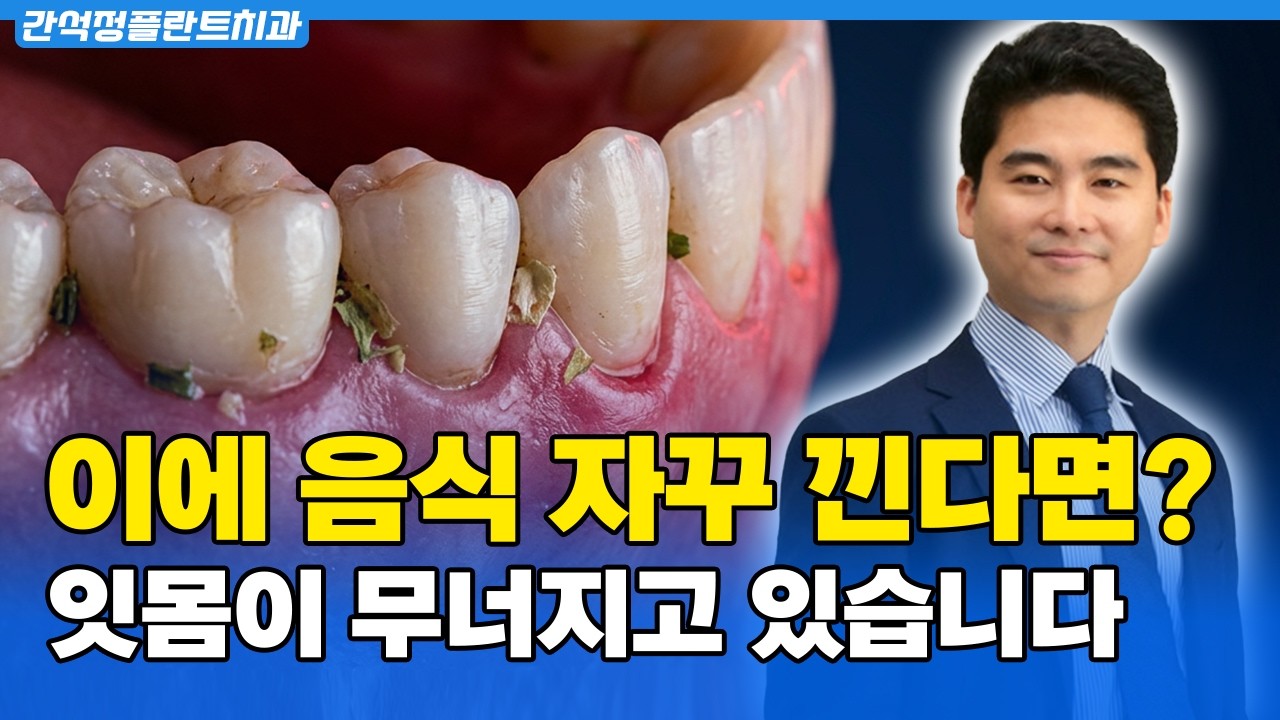 이에 음식물 자꾸 낀다면? 잇몸이 보내는 위험신호 | 음식물 끼는 진짜 원인과 해결법
