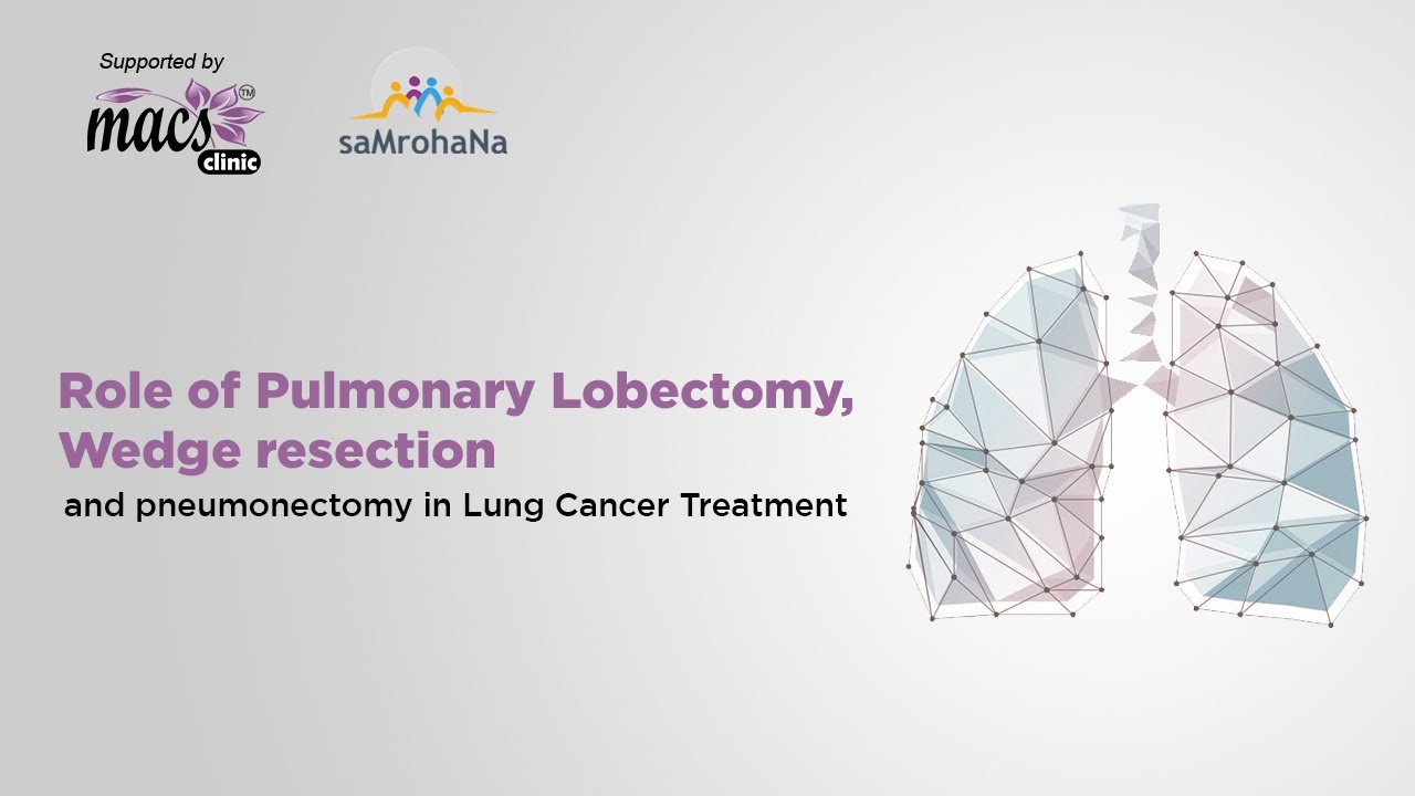 Role of Pulmonary Lobectomy, wedge resection and pneumonectomy in Lung Cancer Treatment | Episode 14