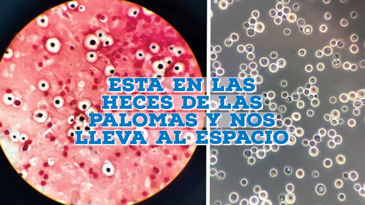 Este Hongo está en las Heces de las Palomas y nos Ayuda en el Espacio | Cryptococcus