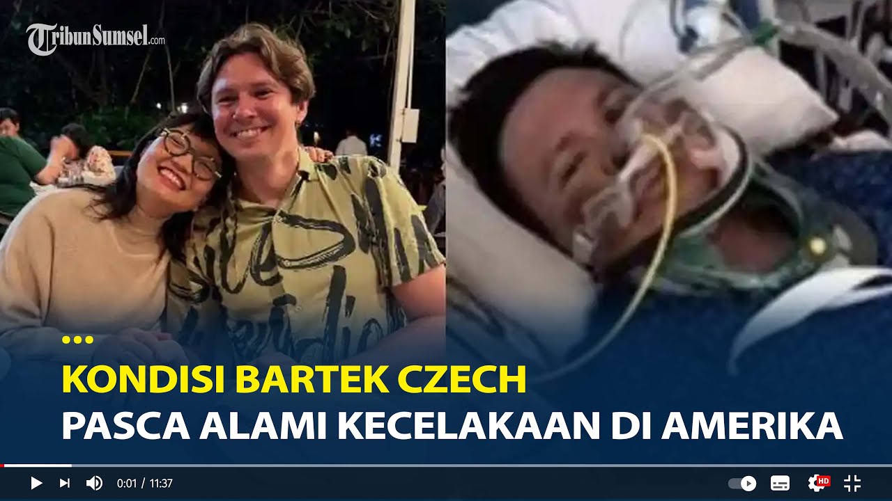 Kondisi Bartek Czech Suami Wamen Diktisaintek Stella Christie Pasca Alami Kecelakaan di Amerika