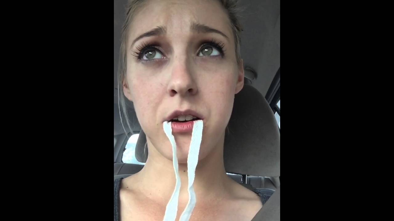 Helena after wisdom tooth extraction. Car trip home.