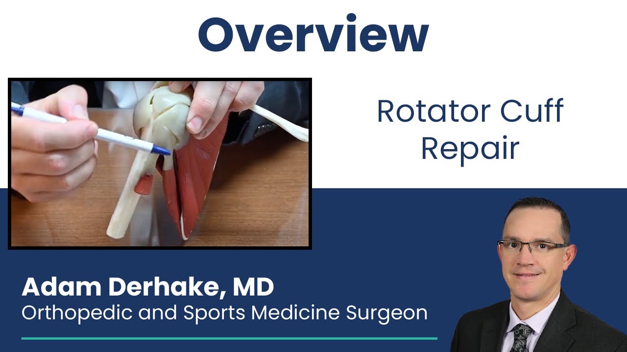 Rotator Cuff Tears: Overview