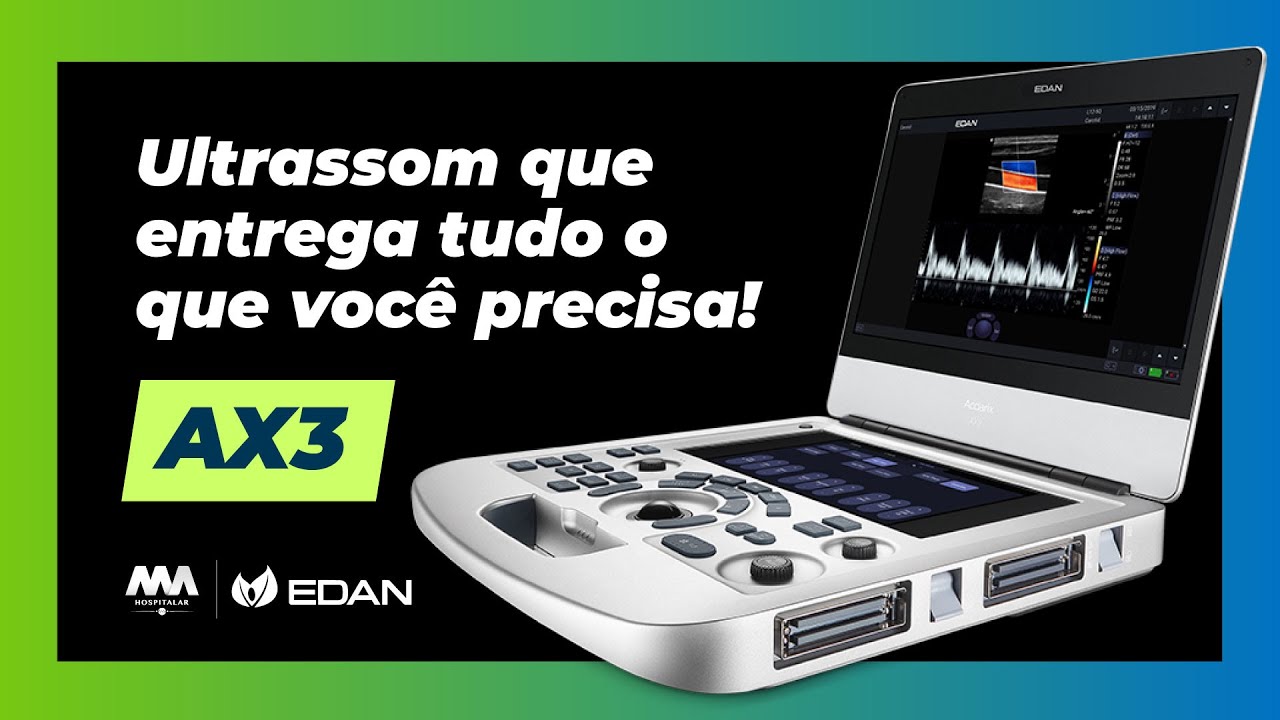Conheça o Ultrassom Edan AX3 — alta performance para diagnósticos clínicos