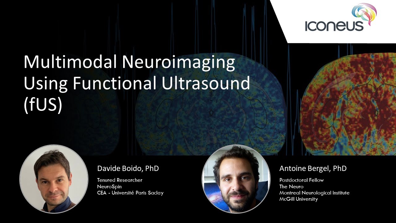 Multimodal Neuroimaging Using Functional Ultrasound (fUS)