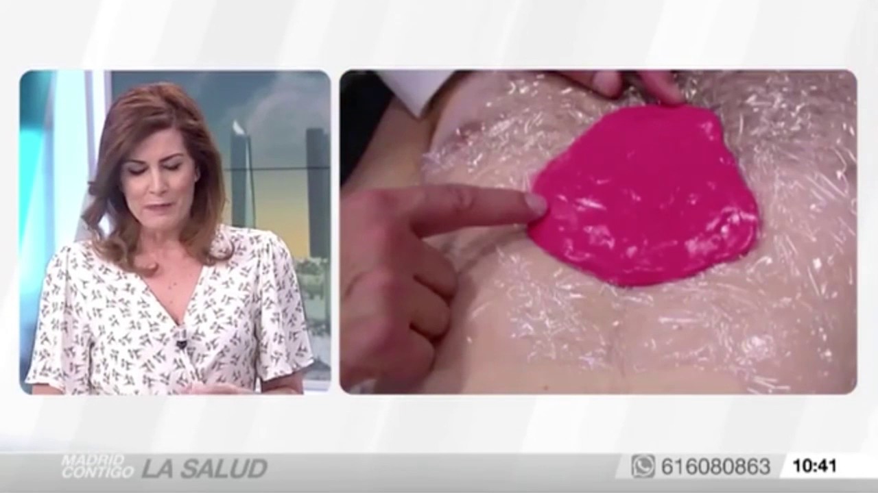 Pectus Excavatum en Telemadrid