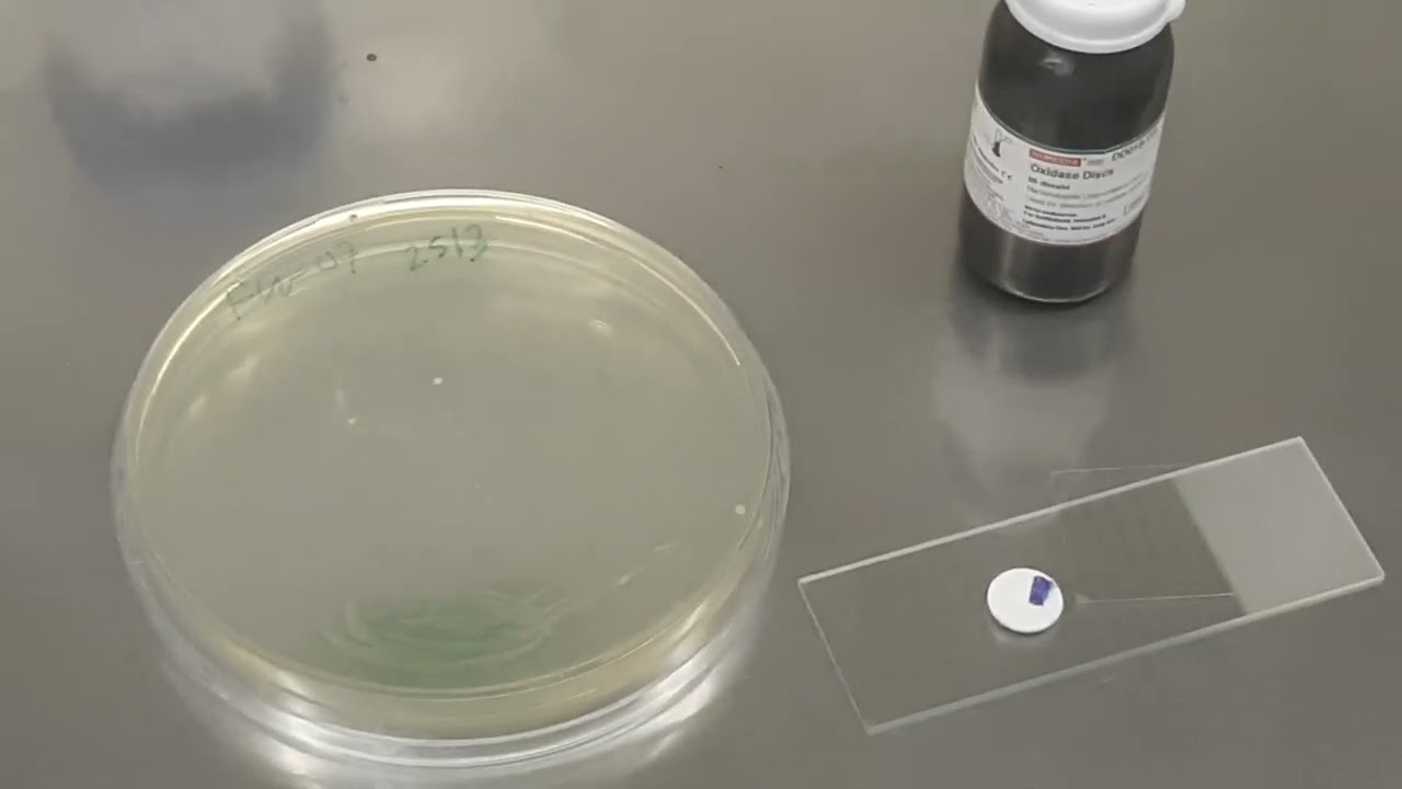 Pseudomonas fluorescens Oxidase test-Positive