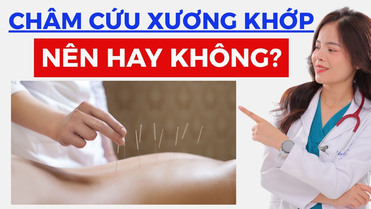 Ngày 19: Châm cứu trong điều trị xương khớp – Khi nào nên làm và hiệu quả thực sự ra sao?